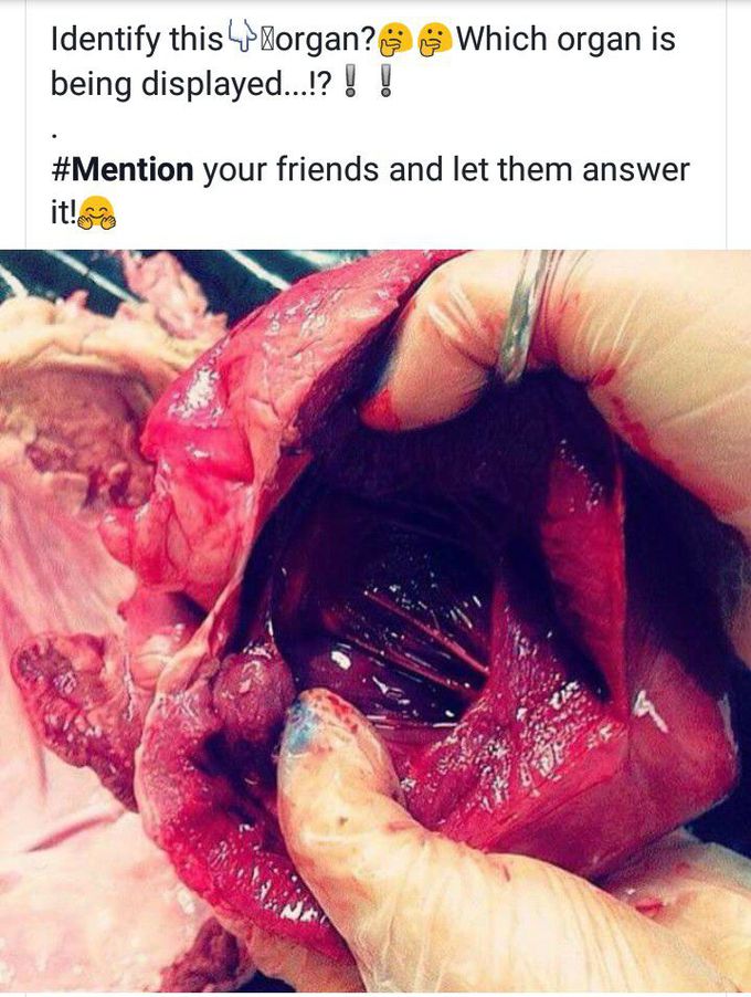 What is a name of this organ ?