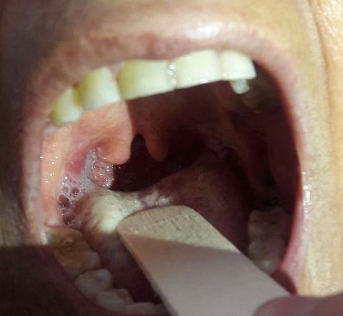 What is your diagnosis?