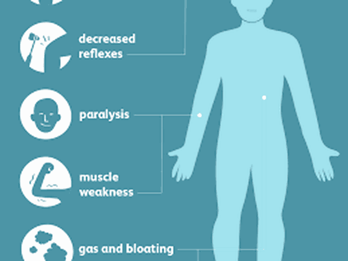 Symptoms of hyperkalemia