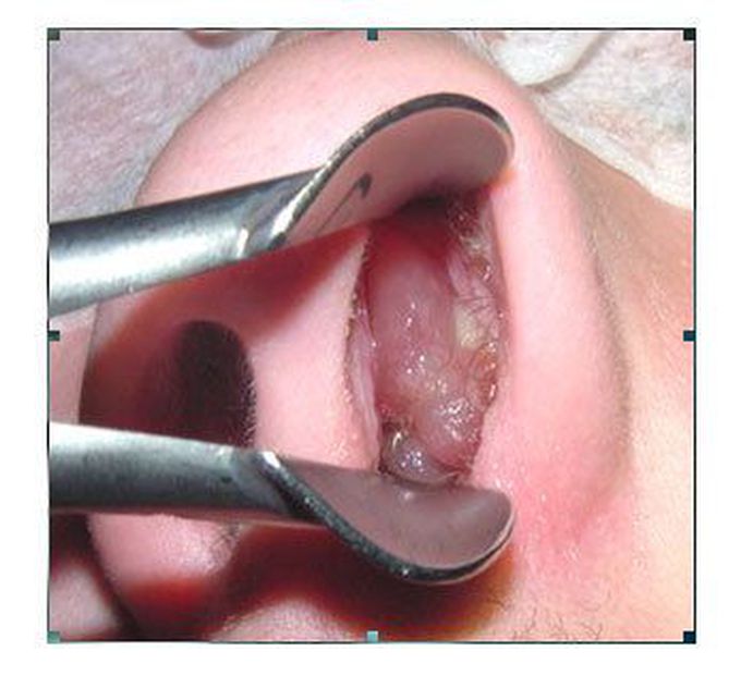 What's your diagnosis?