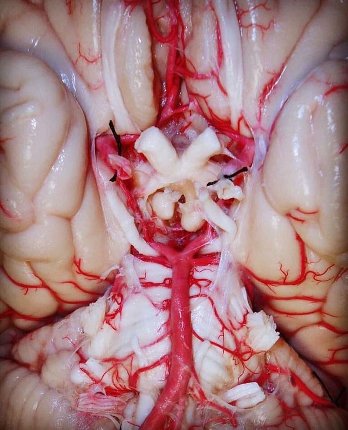 The optic chiasm and the vascular system of the brain