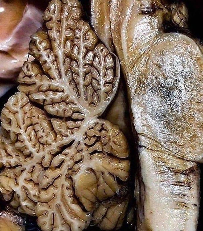 Cerebellum