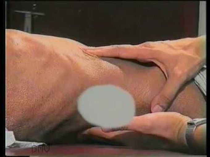 Examination of An Intra abdominal Lump | Dr Ghanshyam Vaidya | CLINICAL EXAMINATION IN SURGERY