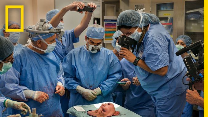 Youngest Face Transplant Recipient in U.S