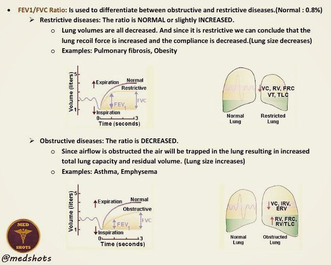 Obstructive vs Restrictive lung diseases made easy!