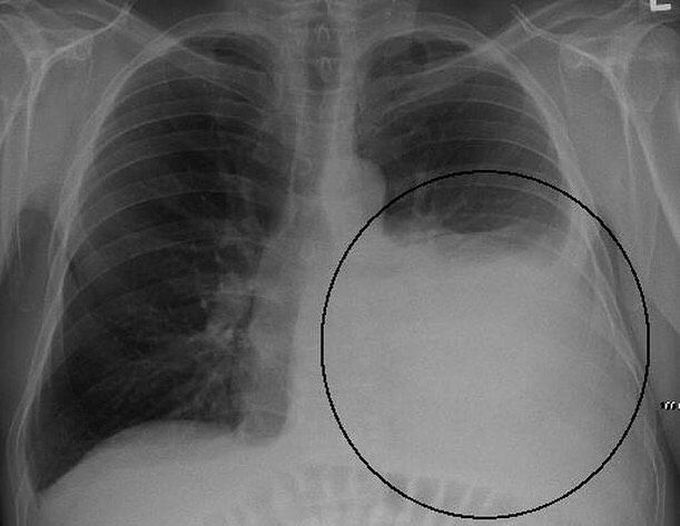 ? what is your diagnosis