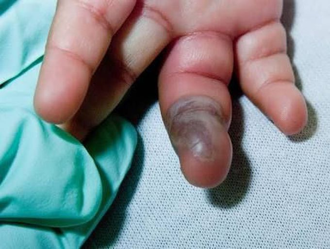 What is your Diagnosis ???