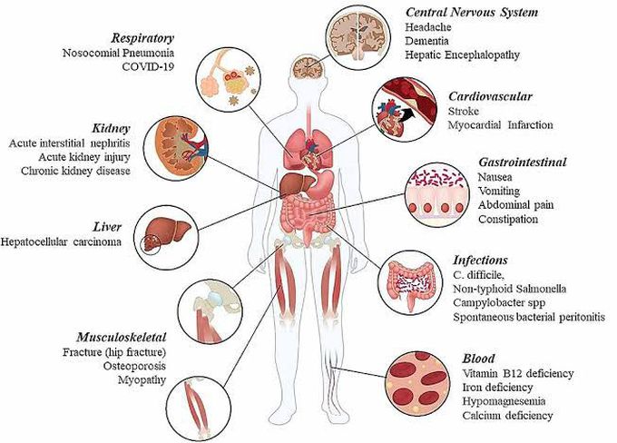 Adverse Effects of PPI