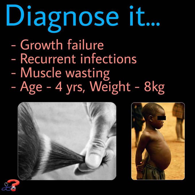 Diagnosi