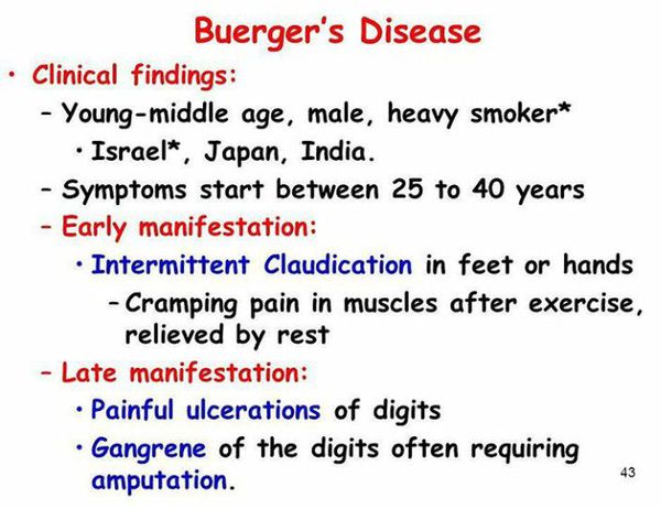 Buerger's disease