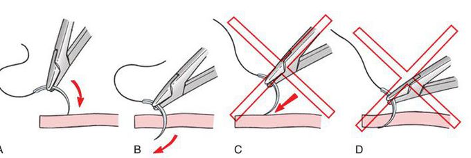 Principles of incision