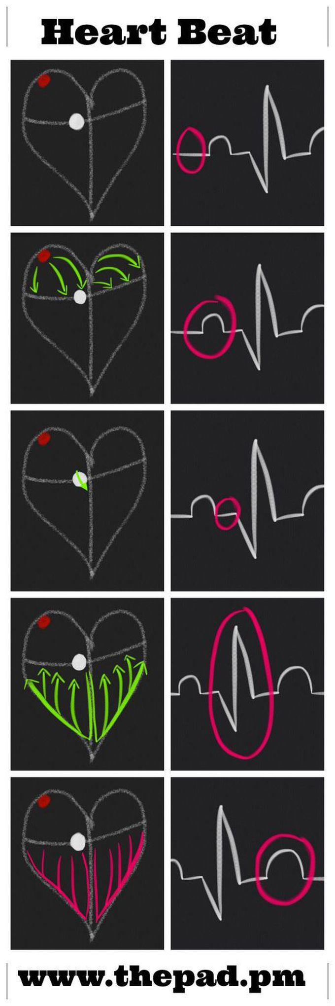EKG..