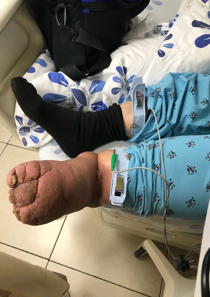 Patient from today