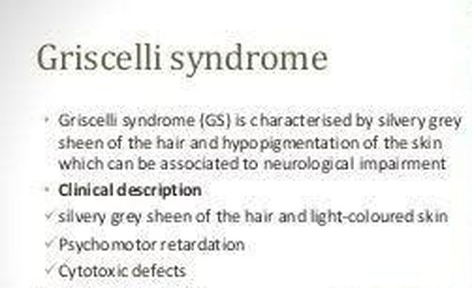 These are the features of Griscelli syndrome