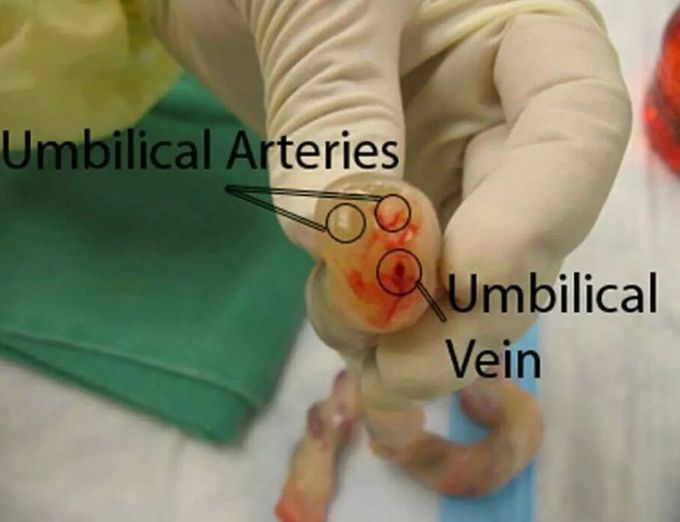  Cross-section of an umbilical cord