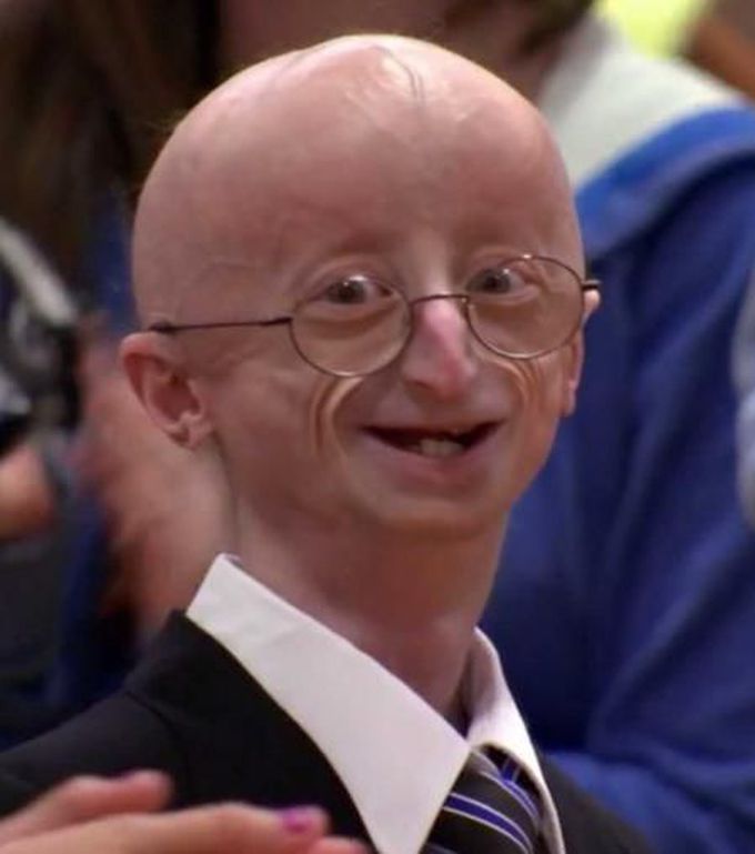 Very rare syndrome