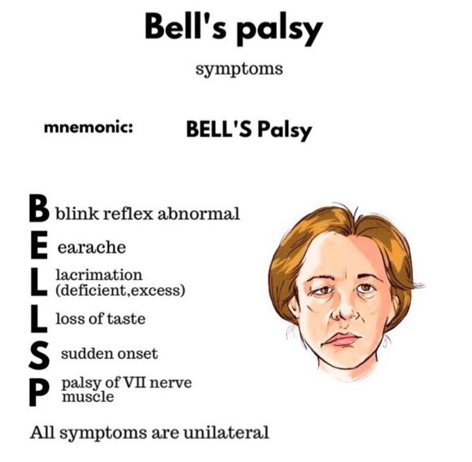 Bell's Palsy