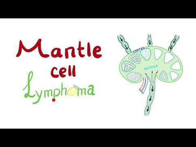Pathology of Mantle Cell Lymphoma