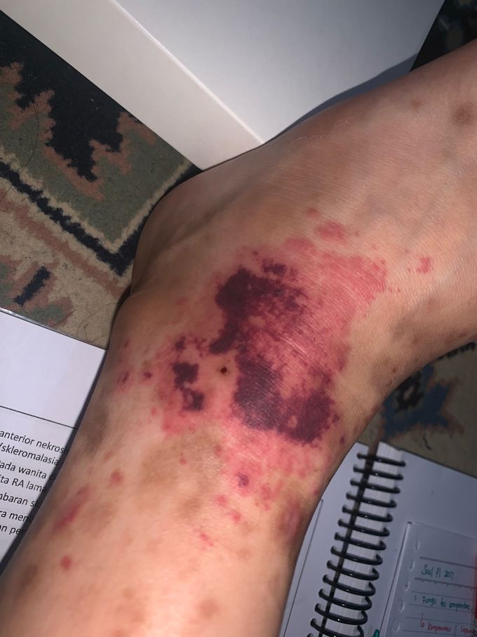 Skin problem or autoimun?