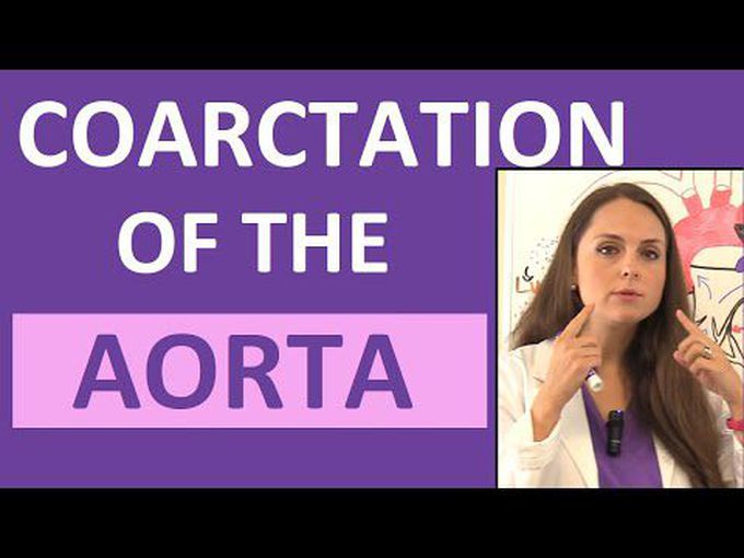 Coarctation of Aorta