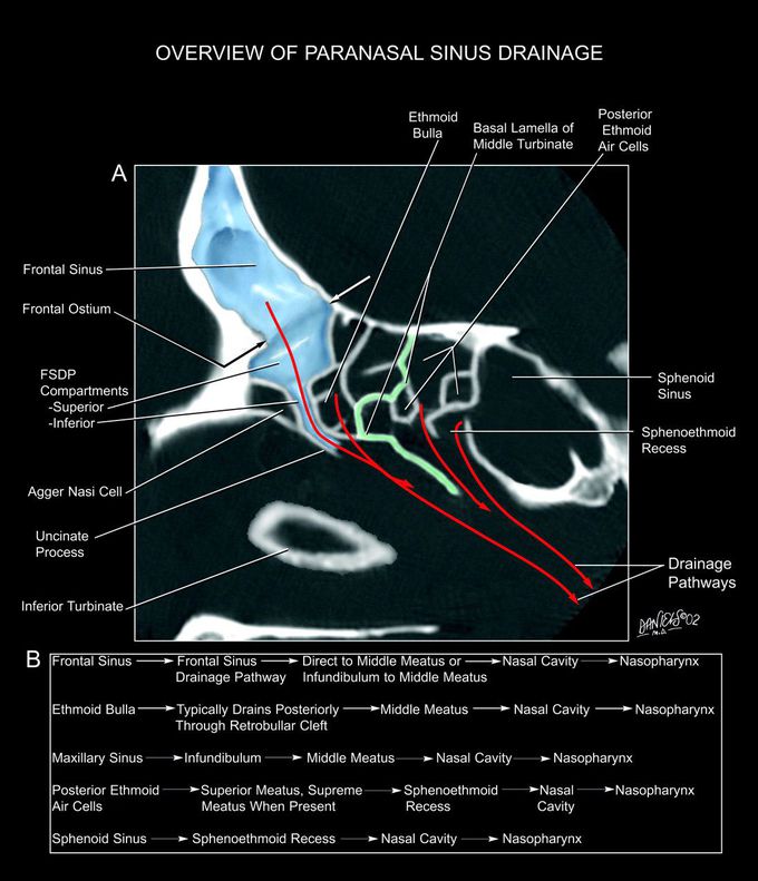 Overview of Paranasal Sinus Drainage