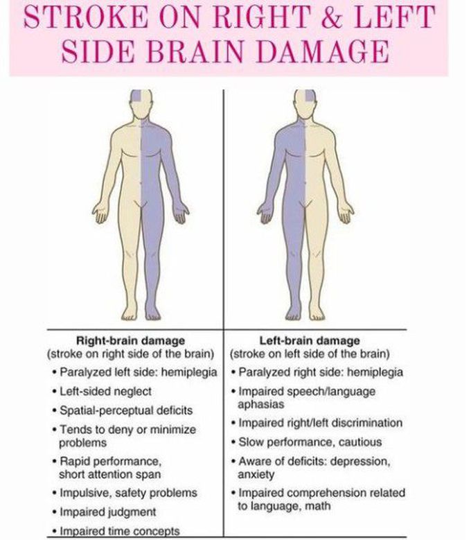 Brain Damage due to Stroke