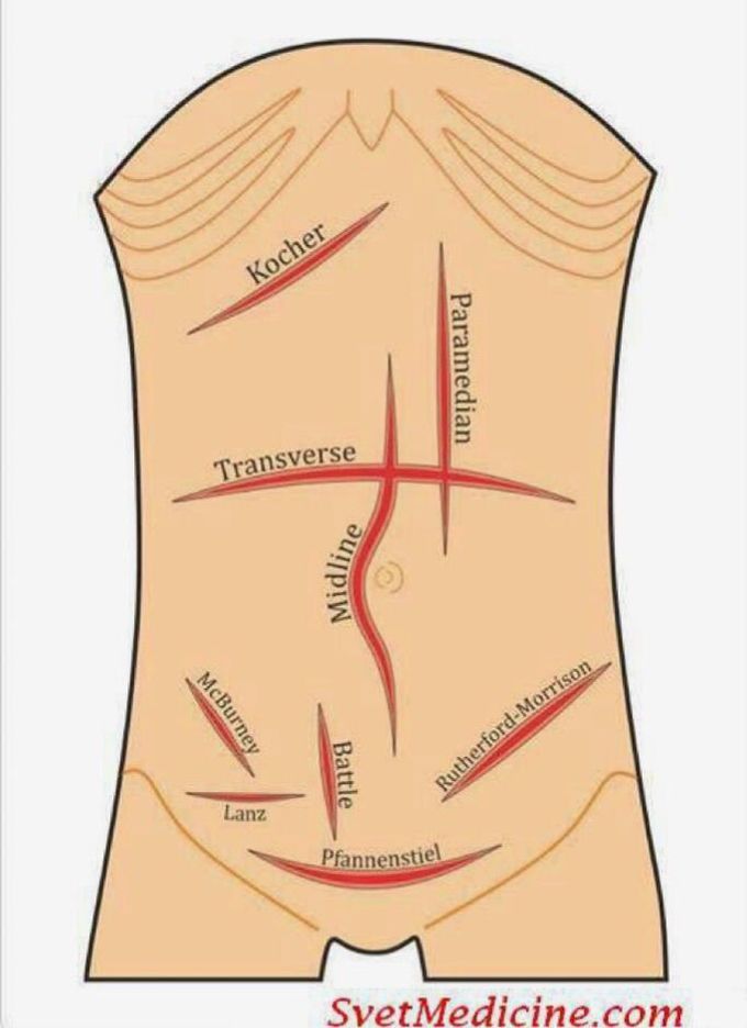 Surgical basic incisions - MEDizzy