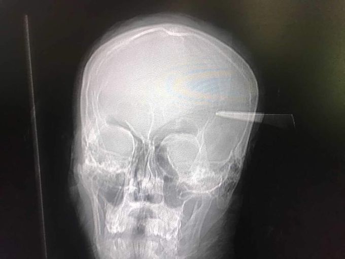 Medical Case