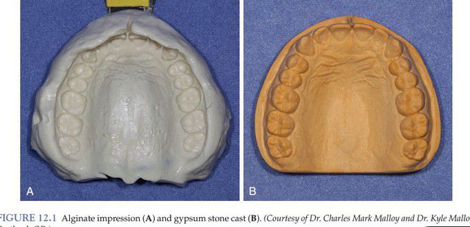 Impression and dental cast