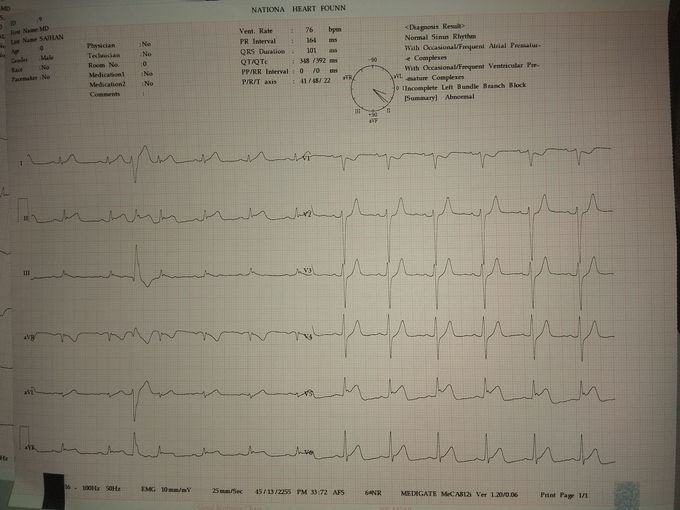 what's ur Dx...?
