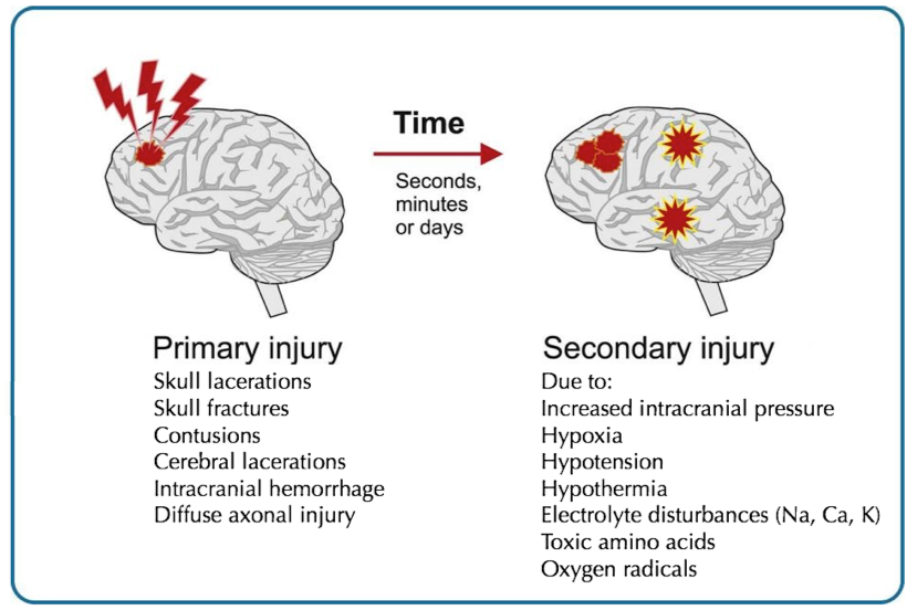 Primary and Secondary Brain Injury
