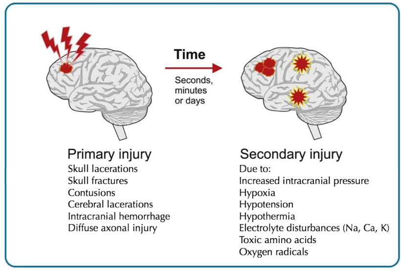 Primary And Secondary Brain Injury Medizzy