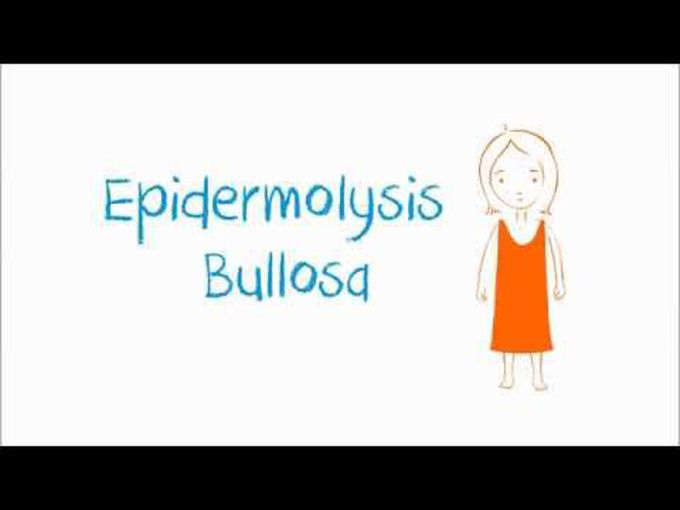 Epidermolysis Bullosa- Non-inflammatory bleeding disorder