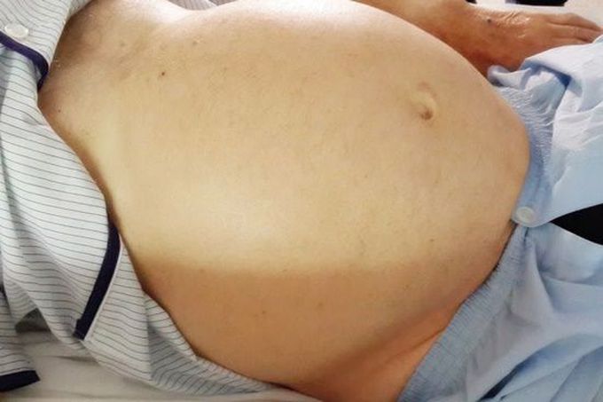 What's your diagnosis?!and Why does it happen??