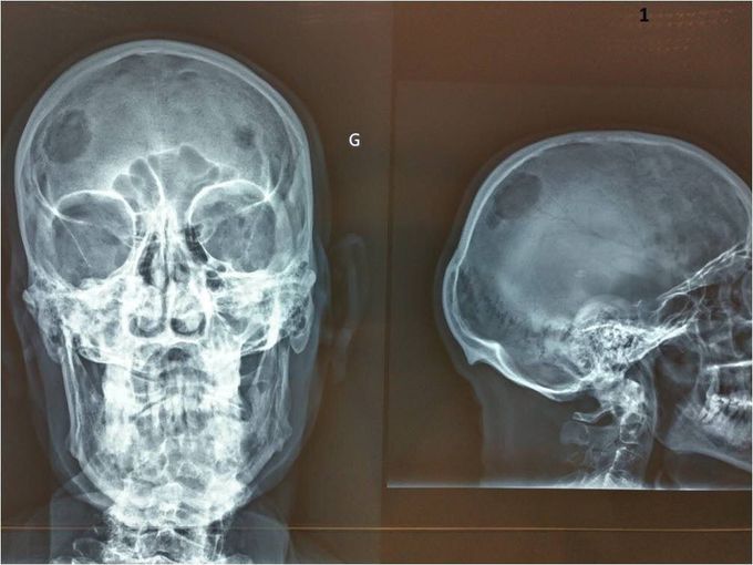 Radiology