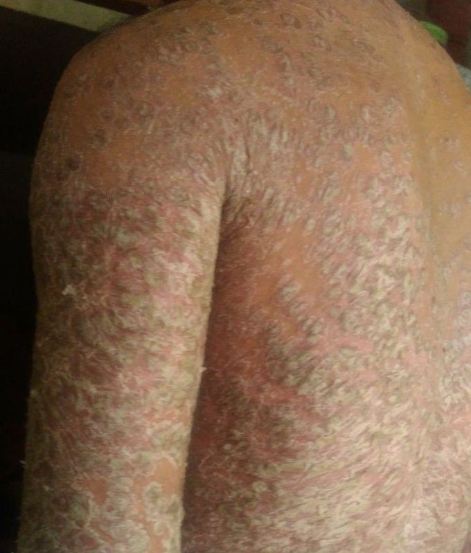 What is your diagnosis ????