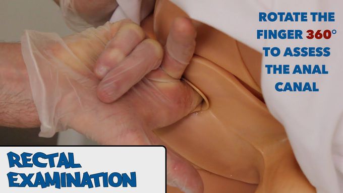 Rectal Examination