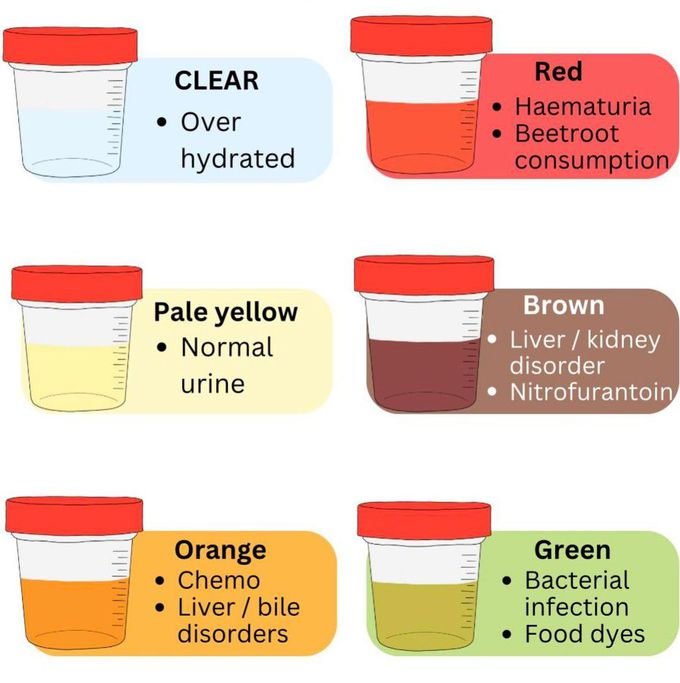 Urine Colors