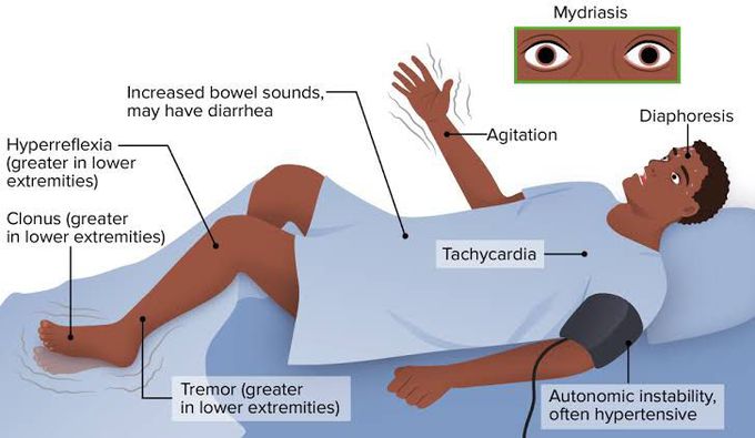 These are the symptoms of Neuroleptic malignant syndrome