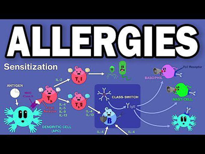 Allergy (Hypersensitivity one)