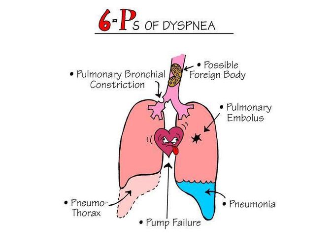 Dyspnea