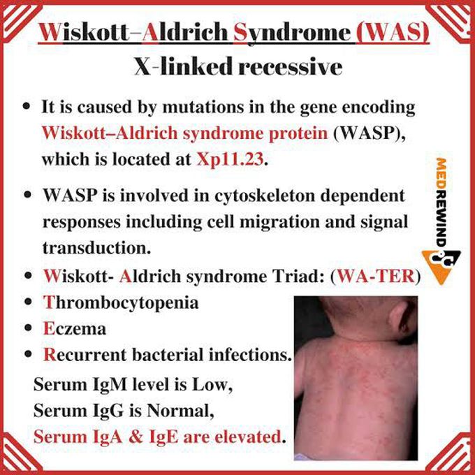 Wiskott-Aldrich Syndrome