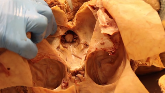 Cranial nerves (C4 - C12)