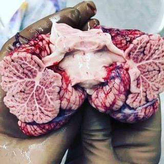 Cerebellum