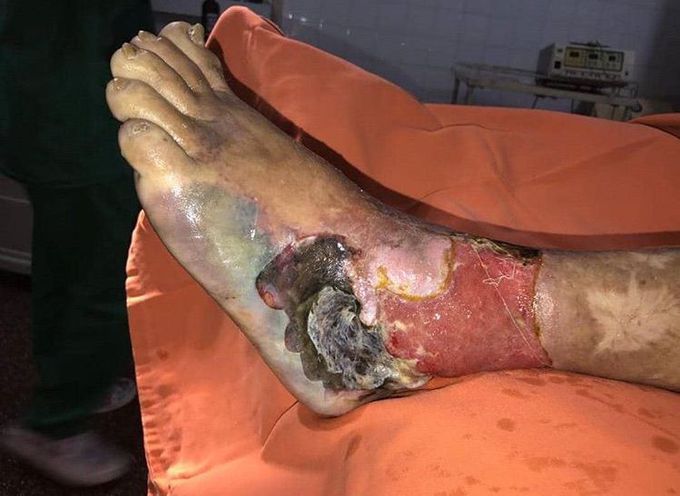 What is your diagnosis