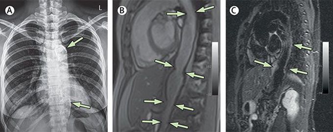What is the diagnosis?