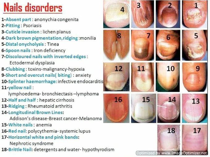 Nails disorders