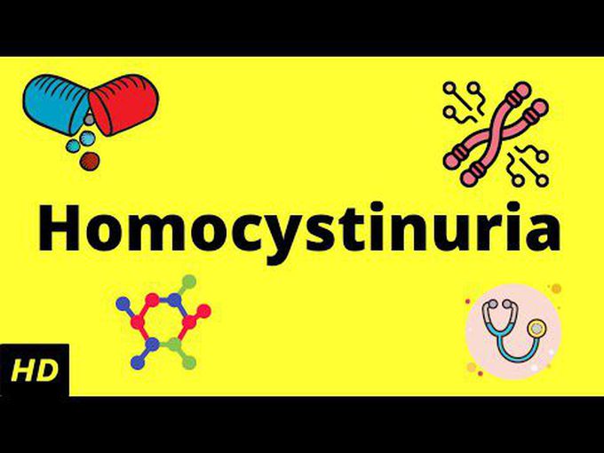 Overview of Homocystinuria