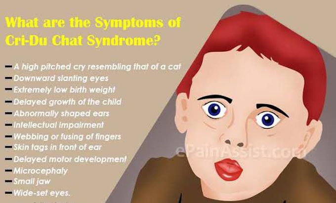 These are the symptoms of Cri-du Chat syndrome