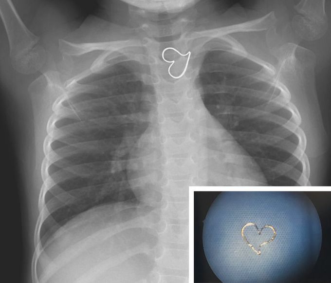 Heart of Gold